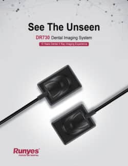 سنسور RVG رانیس